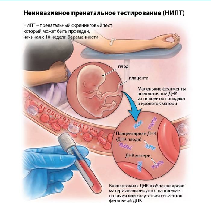 Ikke-invasiv prenatal testing (NIPT)