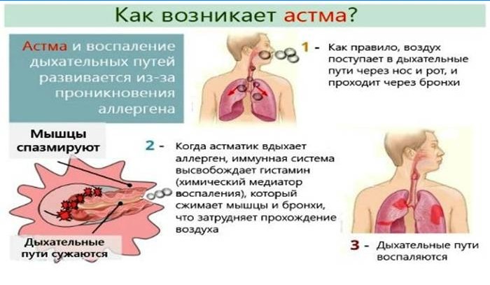Hvordan oppstår astma?