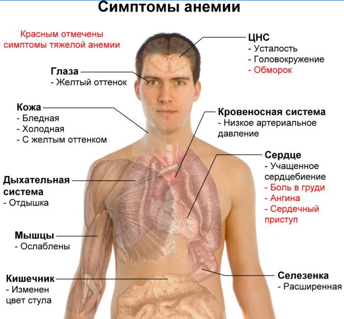 Symptomer på anemi